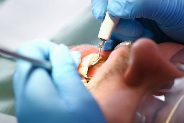 Best Broken or Chipped Tooth Repair in Pratt, KS